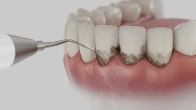 Trusted Wisdom Tooth Removal service in Comanche, OK - Dentist Open Now
